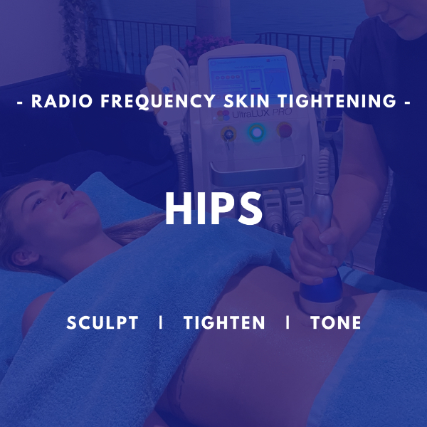 Hips - RF Skin Tightening