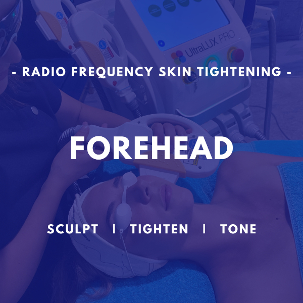 Forehead - RF Skin Tightening