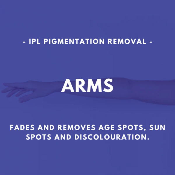 Arms - IPL Pigmentation Removal - Half Arms