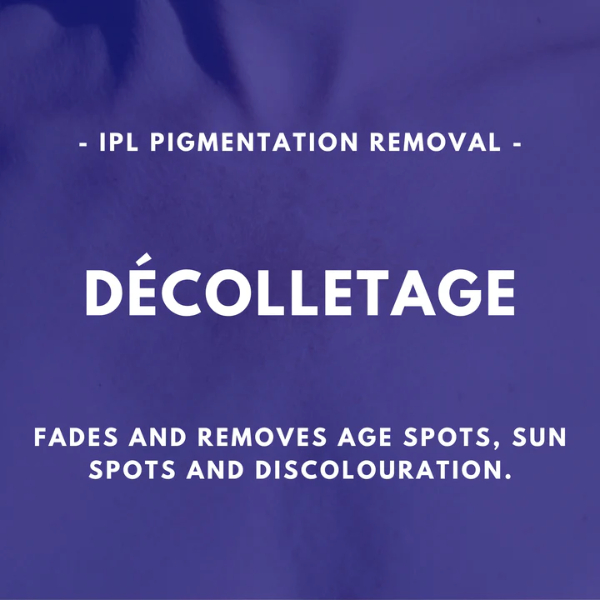 Décolletage - IPL Pigmentation Removal
