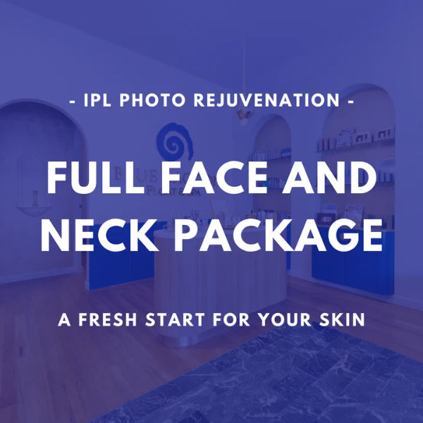 Full Face & Neck - IPL Rejuvenation package