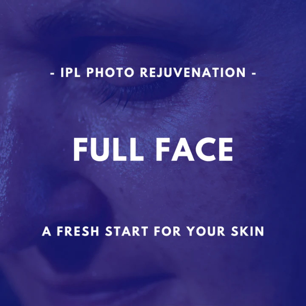 Full Face - IPL Photo Rejuvenation