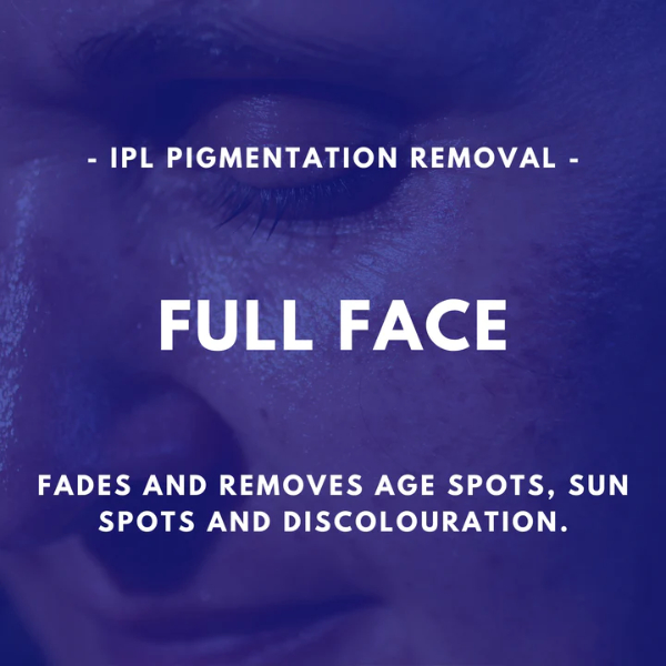 Full Face - IPL Pigmentation Removal