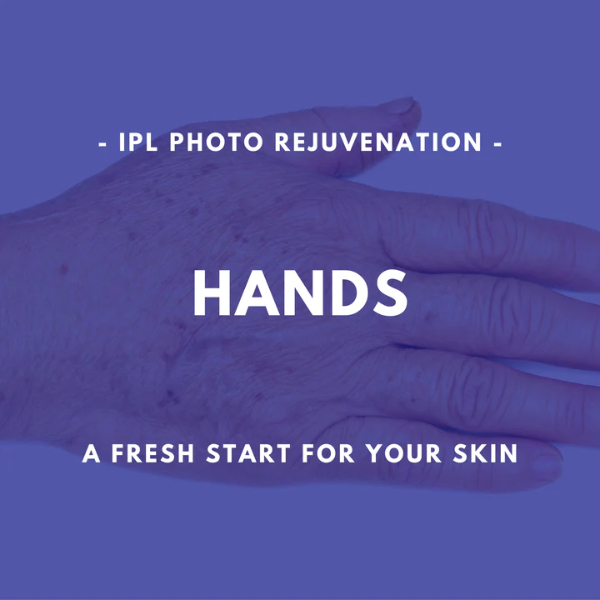 Hands - IPL Photo Rejuvenation