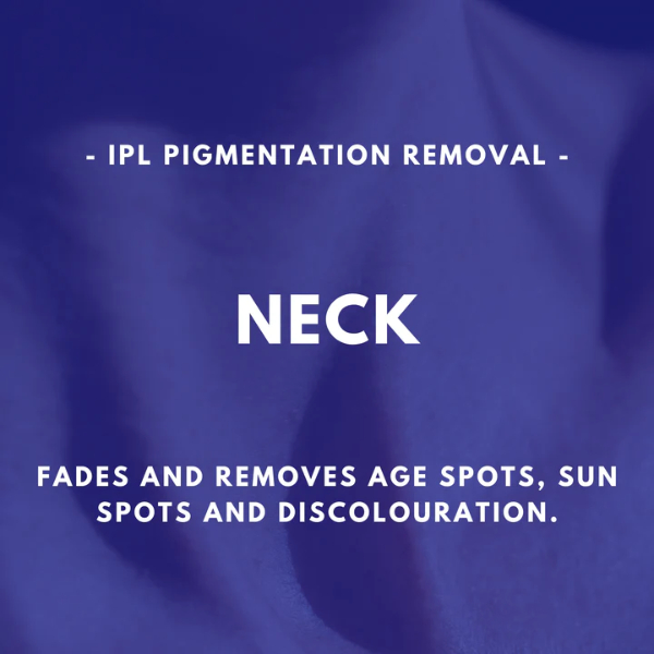 Neck - IPL Pigmentation Removal