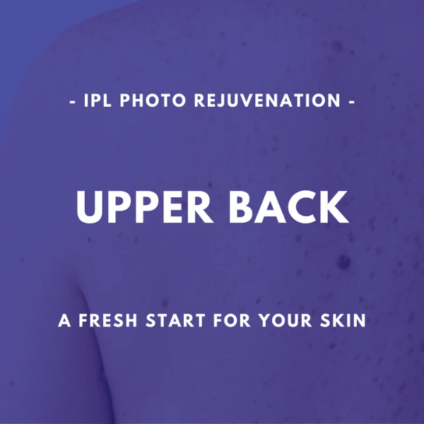 Upper Back - IPL Photo Rejuvenation