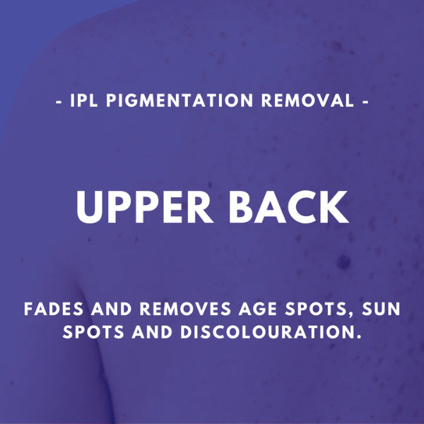 Upper Back - IPL Pigmentation Removal